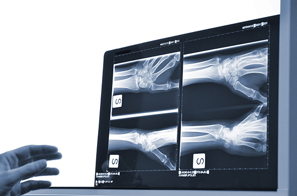 Hand wrist digital dental x-rays Pretoria