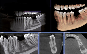 3D digital dental scans Pretoria